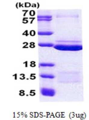 SDS-PAGE: Recombinant Human FAM50A His Protein [NBP2-23035]