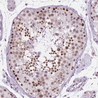 Immunohistochemistry-Paraffin: FAM50B Antibody [NBP2-49529]