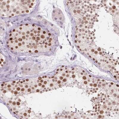 Immunohistochemistry: FAM53A Antibody [NBP2-49274]