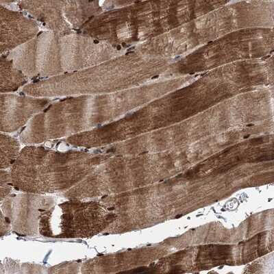 Immunohistochemistry-Paraffin: FAM53A Antibody [NBP1-84998]