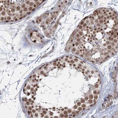 Immunohistochemistry-Paraffin: FAM53A Antibody [NBP1-84998]