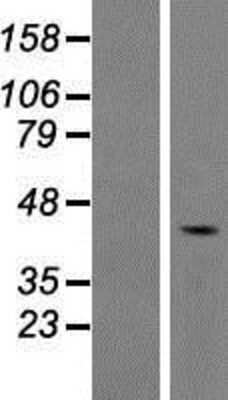 Western Blot: FAM53A Overexpression Lysate [NBP2-08722]