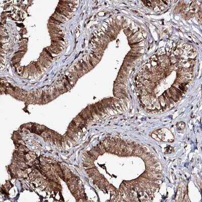 Immunohistochemistry: FAM53B Antibody [NBP2-32701]