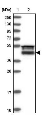 Western Blot: FAM53B Antibody [NBP1-88976]