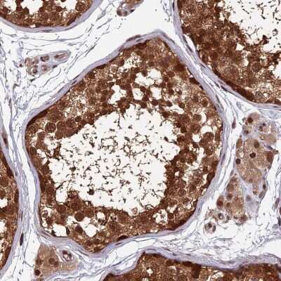 Immunohistochemistry-Paraffin: FAM53C Antibody [NBP1-86769]