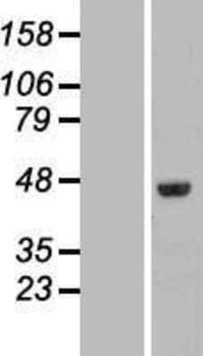 Western Blot: FAM53C Overexpression Lysate [NBL1-10540]