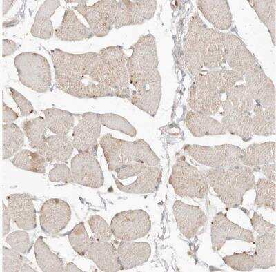Immunohistochemistry-Paraffin: FAM54A Antibody [NBP1-84967]