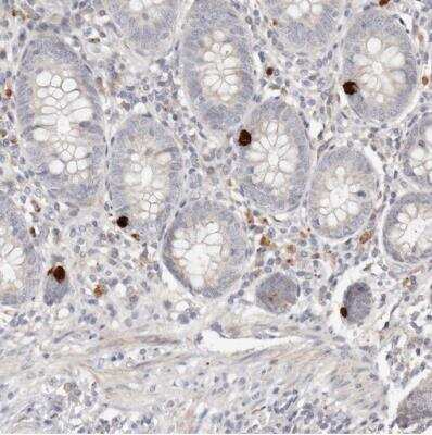 Immunohistochemistry-Paraffin: FAM54A Antibody [NBP1-84967]