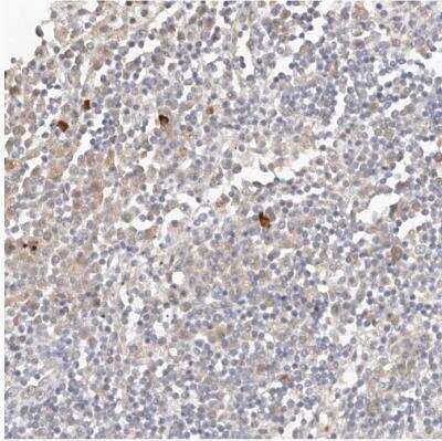 Immunohistochemistry-Paraffin: FAM54A Antibody [NBP1-84967]