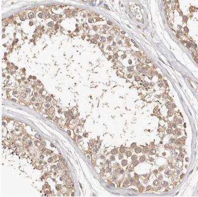 Immunohistochemistry-Paraffin: FAM54A Antibody [NBP1-84967]