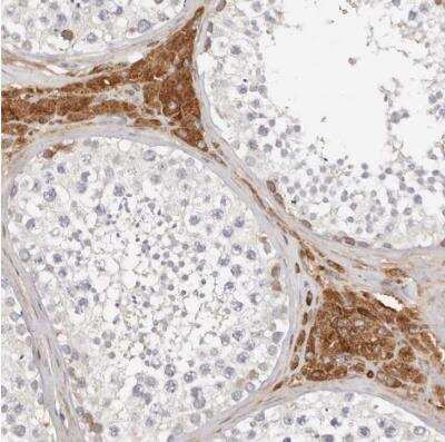 Immunohistochemistry-Paraffin: FAM54A Antibody [NBP1-84968]