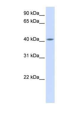 Western Blot: FAM54A Antibody [NBP1-56563]