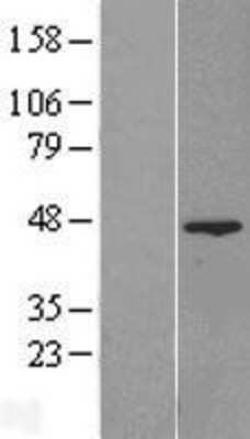 Western Blot: FAM54A Overexpression Lysate [NBL1-10541]