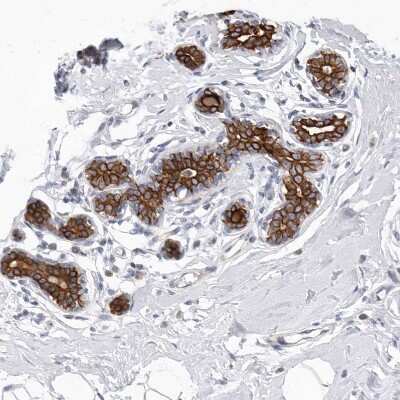 Immunohistochemistry-Paraffin: FAM54B Antibody [NBP1-86400]