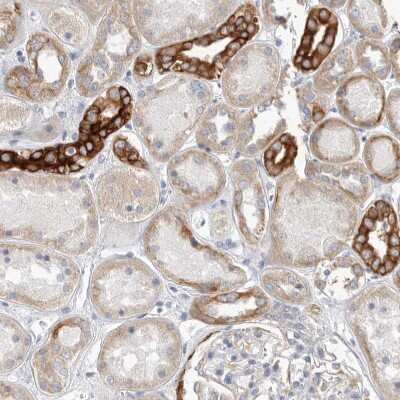 Immunohistochemistry-Paraffin: FAM54B Antibody [NBP1-86400]