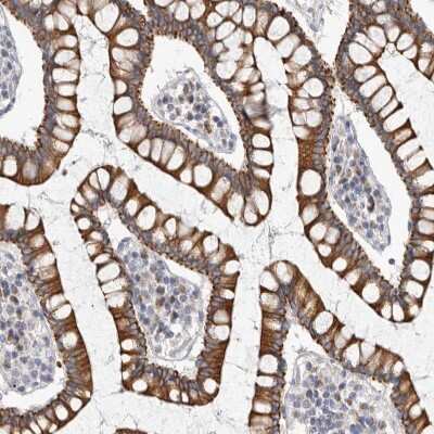 Immunohistochemistry-Paraffin: FAM54B Antibody [NBP1-86400]