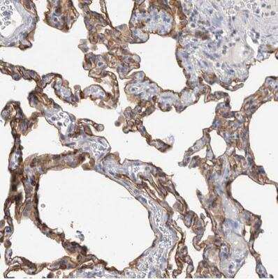 Immunohistochemistry-Paraffin: FAM54B Antibody [NBP1-86400]
