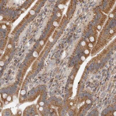 Immunohistochemistry-Paraffin: FAM54B Antibody [NBP1-86401]