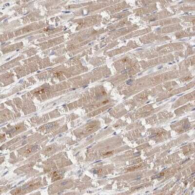 Immunohistochemistry-Paraffin: FAM54B Antibody [NBP1-86401]