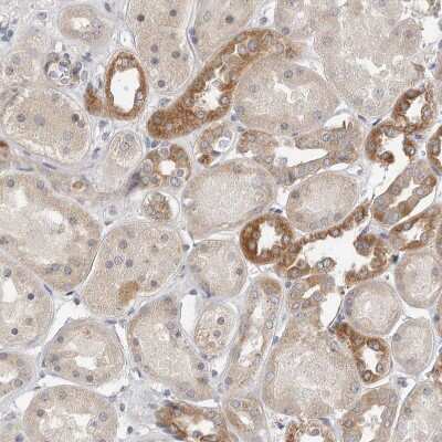 Immunohistochemistry-Paraffin: FAM54B Antibody [NBP1-86401]