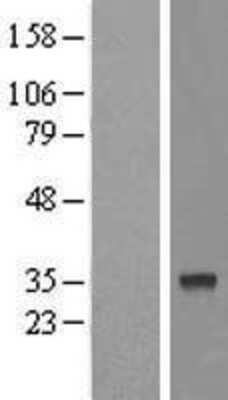 Western Blot: FAM54B Overexpression Lysate [NBL1-10542]