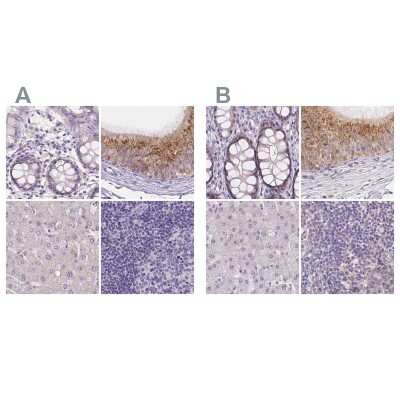 Immunohistochemistry-Paraffin: FAM55B Antibody [NBP2-30771]