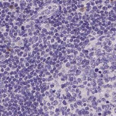 Immunohistochemistry-Paraffin: FAM55B Antibody [NBP2-30771]