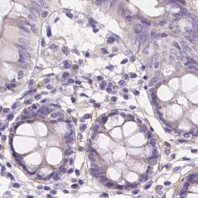 Immunohistochemistry-Paraffin: FAM55B Antibody [NBP2-30771]