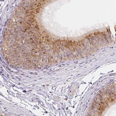 Immunohistochemistry-Paraffin: FAM55B Antibody [NBP2-31001]