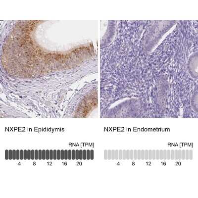Immunohistochemistry-Paraffin: FAM55B Antibody [NBP2-31001]