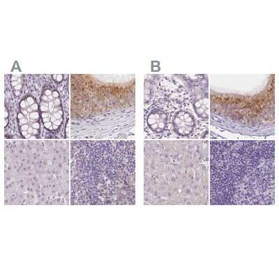 Immunohistochemistry-Paraffin: FAM55B Antibody [NBP2-31001]
