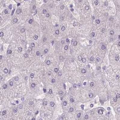 Immunohistochemistry-Paraffin: FAM55B Antibody [NBP2-31001]