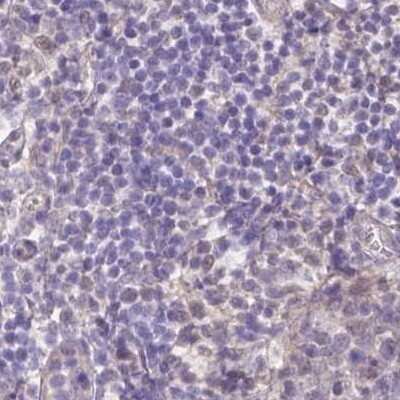 Immunohistochemistry-Paraffin: FAM55B Antibody [NBP2-31001]