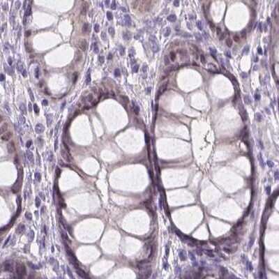 Immunohistochemistry-Paraffin: FAM55B Antibody [NBP2-31001]