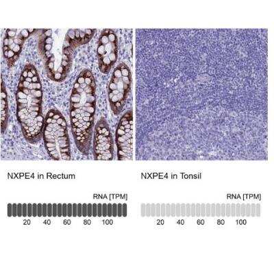 Immunohistochemistry-Paraffin: FAM55D Antibody [NBP1-88548]