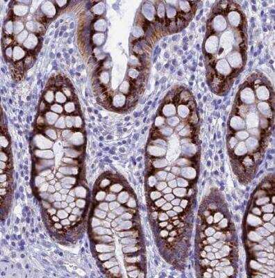 Immunohistochemistry-Paraffin: FAM55D Antibody [NBP1-88548]