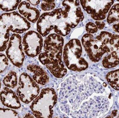Immunohistochemistry-Paraffin: FAM55D Antibody [NBP1-88548]