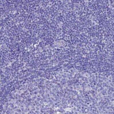 Immunohistochemistry-Paraffin: FAM55D Antibody [NBP1-88548]