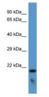 Western Blot: FAM57B Antibody [NBP3-09270]