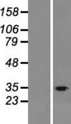 Western Blot: FAM57B Overexpression Lysate [NBL1-10545]