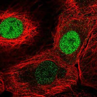 Immunocytochemistry/ Immunofluorescence: FAM58A Antibody [NBP2-56810]