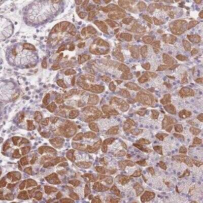 Immunohistochemistry-Paraffin: FAM58A Antibody [NBP2-14001]