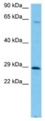 Western Blot: FAM58A Antibody [NBP3-10183]