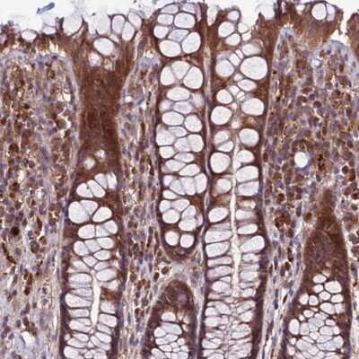 Immunohistochemistry-Paraffin: FAM59A Antibody [NBP2-48757]