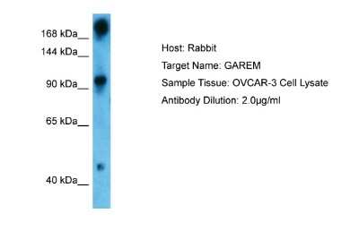 Western Blot: FAM59A Antibody [NBP2-84920]