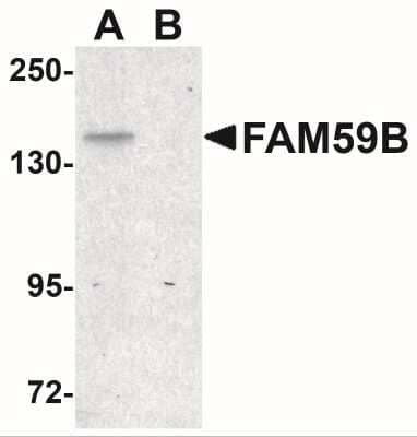 Western Blot: FAM59B AntibodyBSA Free [NBP2-41118]