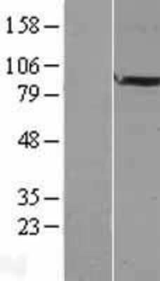 Western Blot: FAM5B Overexpression Lysate [NBL1-10547]