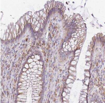 Immunohistochemistry-Paraffin: FAM5C Antibody [NBP2-31581]