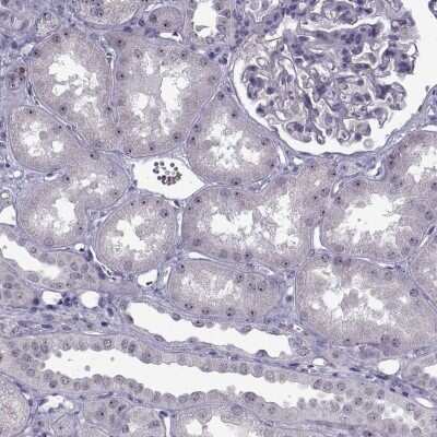 Immunohistochemistry-Paraffin: FAM60A Antibody [NBP2-68734]