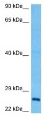 Western Blot: FAM60A Antibody [NBP3-10171]